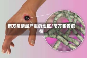 南方疫情最严重的地区/南方各省疫情