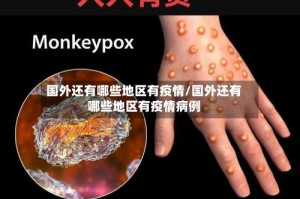 国外还有哪些地区有疫情/国外还有哪些地区有疫情病例