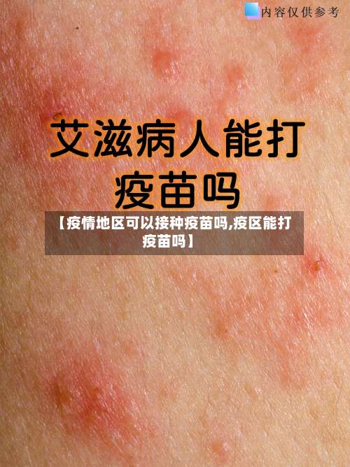 【疫情地区可以接种疫苗吗,疫区能打疫苗吗】-第1张图片