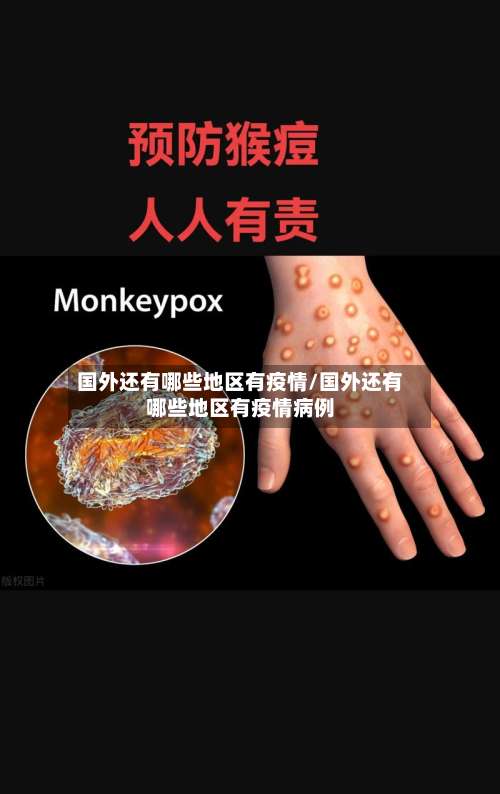 国外还有哪些地区有疫情/国外还有哪些地区有疫情病例-第1张图片