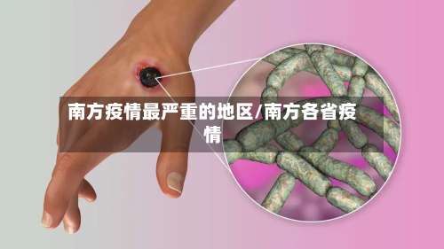 南方疫情最严重的地区/南方各省疫情-第1张图片