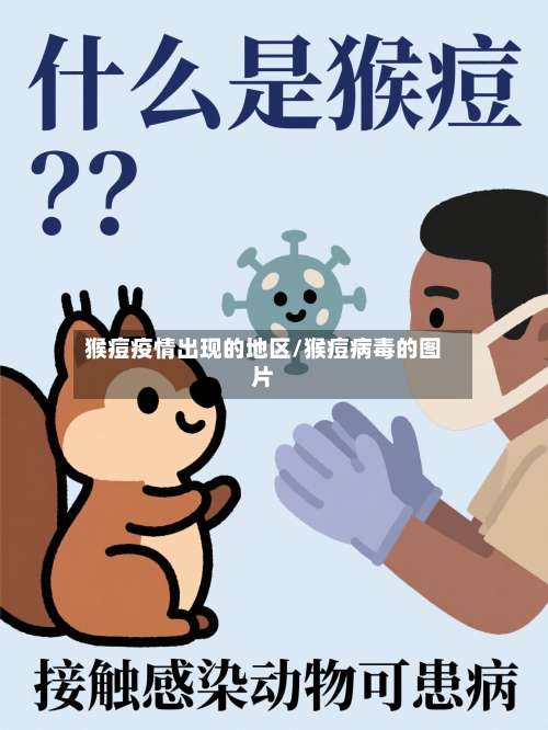 猴痘疫情出现的地区/猴痘病毒的图片-第2张图片