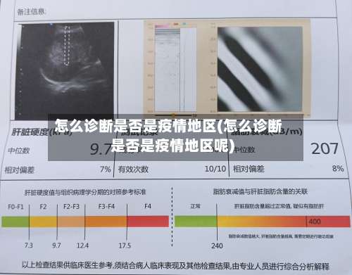 怎么诊断是否是疫情地区(怎么诊断是否是疫情地区呢)-第1张图片