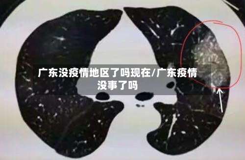 广东没疫情地区了吗现在/广东疫情没事了吗-第2张图片
