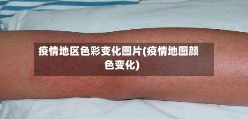 疫情地区色彩变化图片(疫情地图颜色变化)-第3张图片